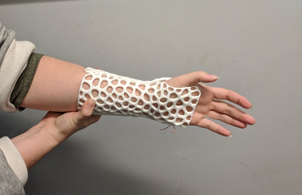 how-to-design-custom-3d-printable-braces-for-arm-injury-piper3dp